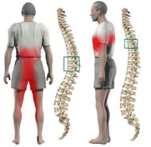 Saínte na columna vertebral