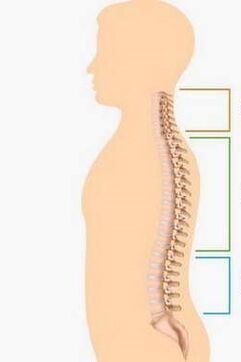 derrota por osteocondrose de diferentes partes da columna vertebral