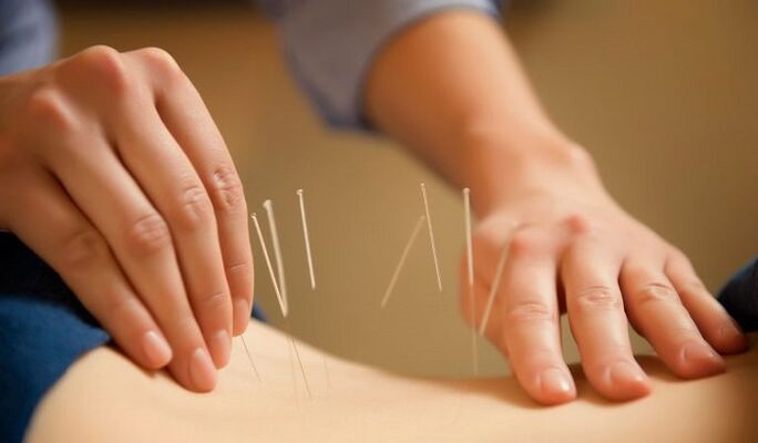 acupuntura para tratar a dor lumbar